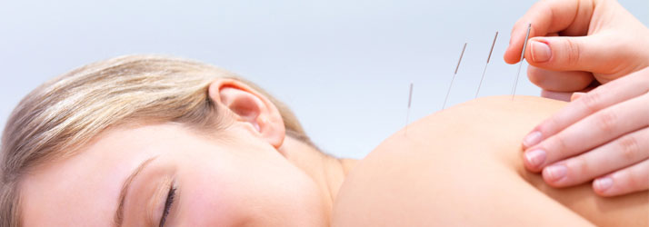 Chiropractic St. Charles IL How Acupuncture Reduces Stress Chiropractic St. Charles IL How Acupuncture Reduces Stress